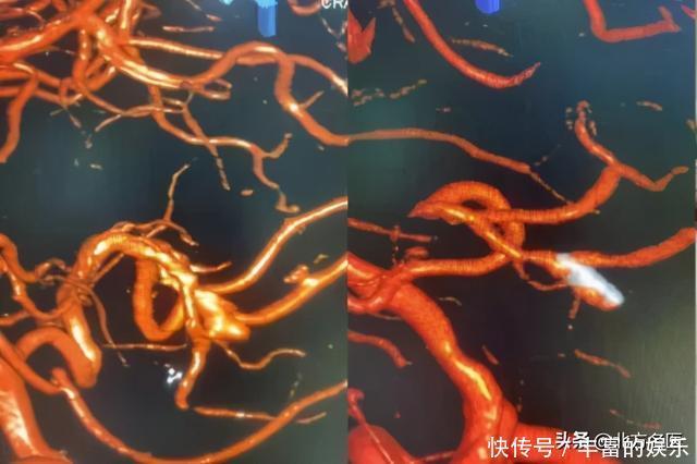 醒来|7岁男孩突然昏迷,醒来后说“妈妈,我要抱抱”