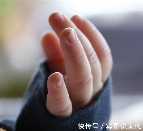 咬指甲|5岁女孩喜欢“咬指甲”,宝妈无奈求医,医生太晚了,拔了吧