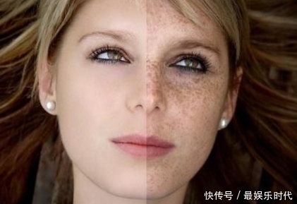 脸部|最伤女性皮肤的3件事,件件都会让黑色素沉淀,还容易显老!