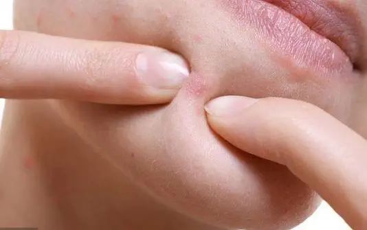 肝脏|肝部变脏，会出现4个异常，坚持“七个一”，给肝洗洗澡，排排毒