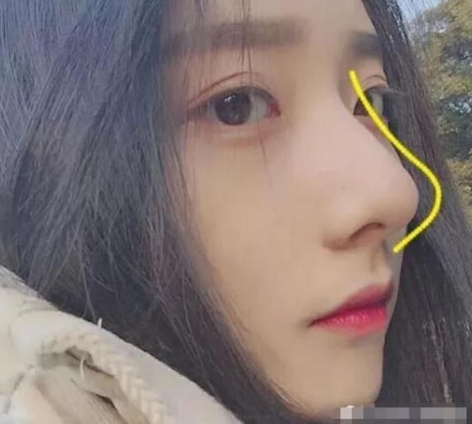 女生若想鼻子“光滑”，坚持这3个好习惯，和“草莓鼻”说拜拜