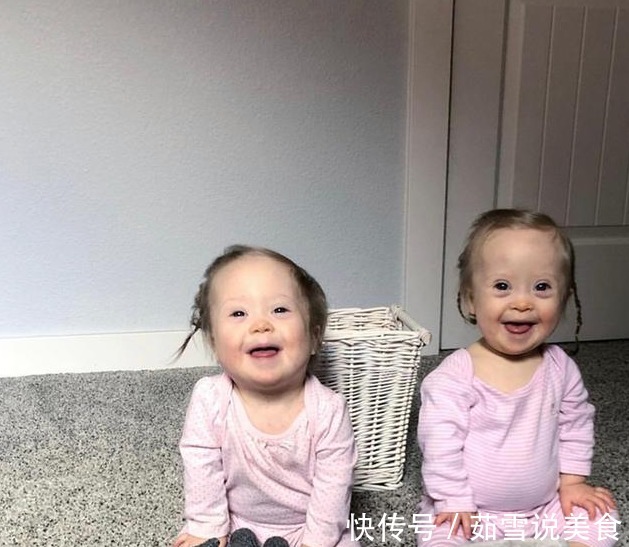 唐氏双胞胎|妈妈生下唐氏双胞胎姐妹，并不轻言放弃，唐宝都有一张相同的脸