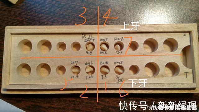 家长们|送给孩子正在换牙的父母们，你们一直都做错了什么？