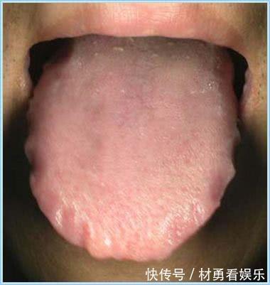 肢端|身上有三道“邪印儿”,说明健康要出问题