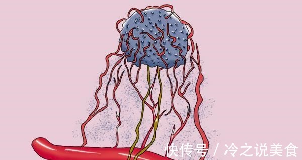 肺癌|夫妻俩先后查出肺癌,医生手部早就给出提醒,却没及时发觉