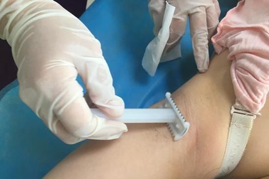 宝妈|顺产“备皮”尴尬?剃毛这一关,剖腹产产妇也躲不过,别不好意思