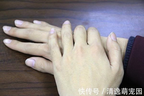 糖尿病|肝硬化先上手脚,手脚的哪些变化,暗示了肝硬化可能找上门了?