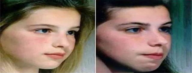 水肿|医院“黑脸宝宝”走红,妈妈忍住“没扔”,2月后完美逆袭