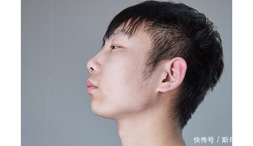 迹象|肿瘤医生:身体频繁有3个迹象,或是甲状腺癌“一级预警”