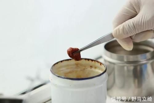 药膏|4岁宝宝掉入170度油锅,奶奶3步救下孩子,医生:急救措施很专业