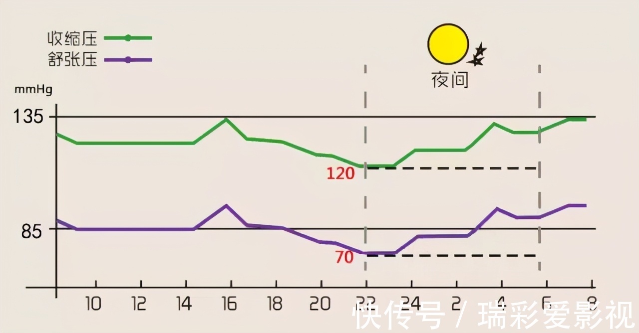 血管壁|高血压不吃药，如何降血压？医生告诉你这6个方法，简单又实用