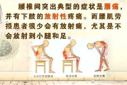 临床症状|腰椎间盘突出症的临床症状 你了解吗