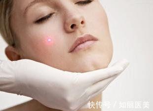 面部吸脂 面部吸脂后头套一般戴多少天?想要术后不松弛这两点要注意!