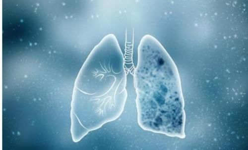 手术切除|体内有“结节”的人，4种“发物”尽量少吃，不妨了解