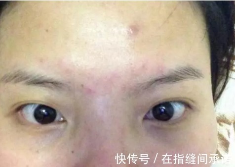 怀孕|孕晚期,孕妈若出现这些表现,说明体内“胎毒”堆积,要留心