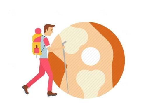 半月板|十年暴走却换掉膝盖？医生：走路锻炼虽好，但也要注意这些事项