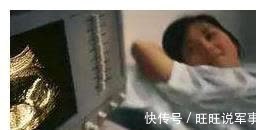 发育|产检一共要做几次大排畸检查?分别是在什么时间?一次讲清楚!