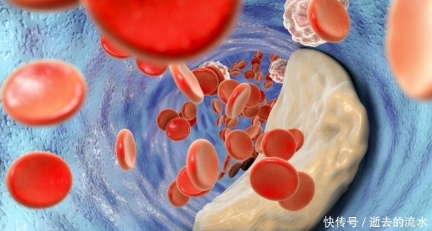 56岁大姐不吃肥肉,甘油三酯9.8,医生:2素天天吃,血脂不高才怪