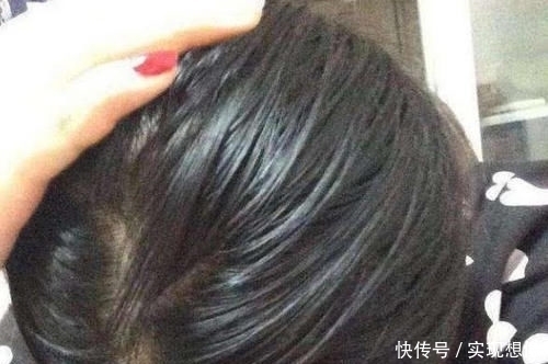 冬天头皮屑过多，是源于这4种坏习惯，若能改善头发清爽又干净