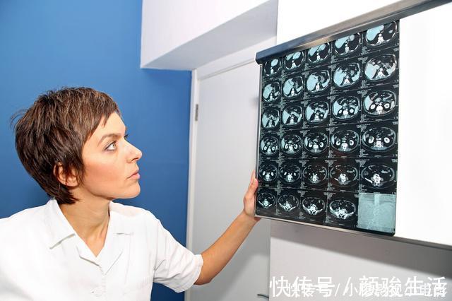 手术切除|为什么医生总是让癌症患者做CT检查?三大作用,你可能不了解