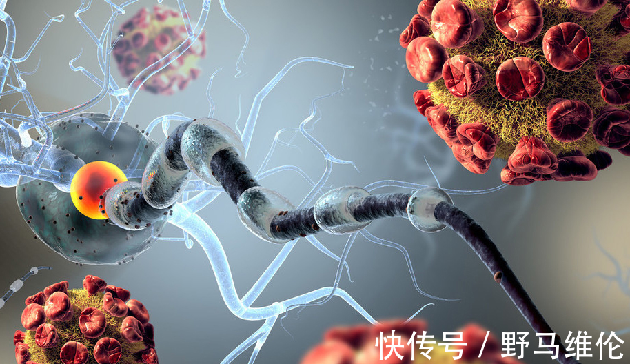 转移|诊断肺癌后每天跑五公里,还是复发转移了,运动会加速肿瘤发展吗