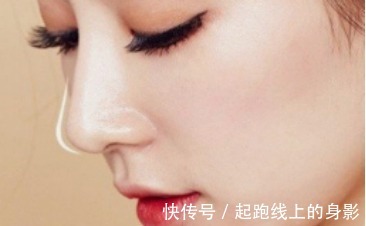 风险 鼻炎能做隆鼻手术吗隆鼻之后会有哪些术后风险!