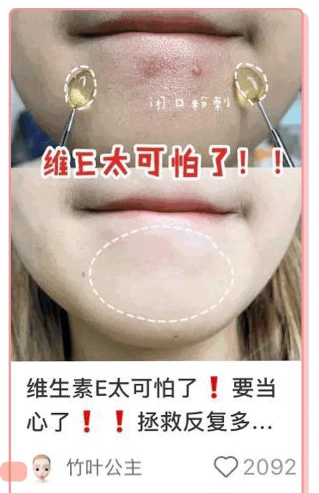 你的护肤方式上黑名单了吗辟谣10个火爆全网的烂脸护肤伪科学