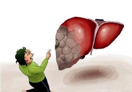 心肌梗塞|不论你酒瘾有多大，若得了这6种病，建议远离酒精，早知道早好