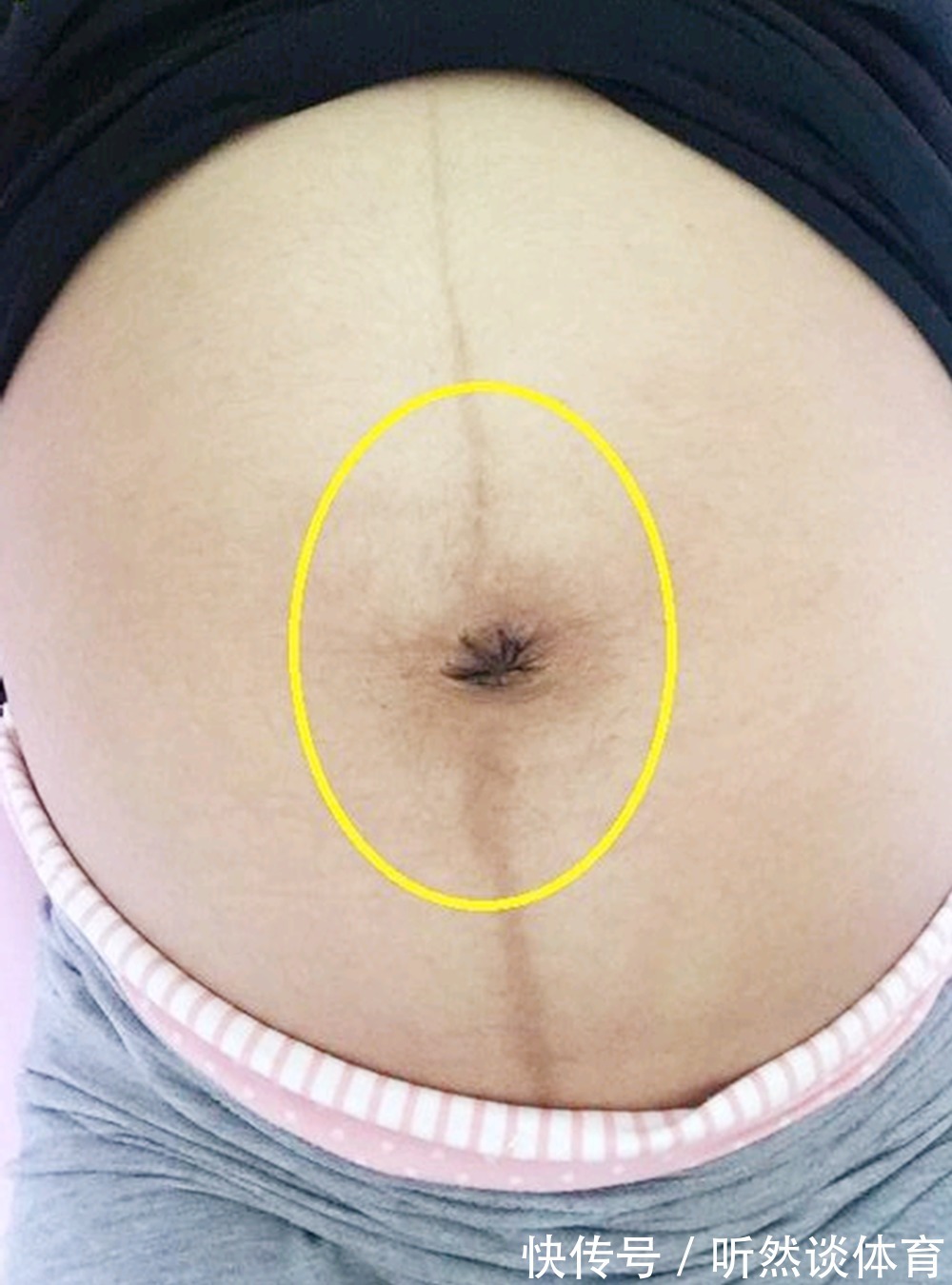 妈妈|孕妈怀孕后,肚脐也发生了变化,“凸”出来的原因无外乎三种