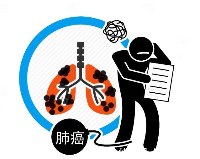 肺部|预防肺癌体检少不了!医生告知:筛查肺病,这项检查不能少!