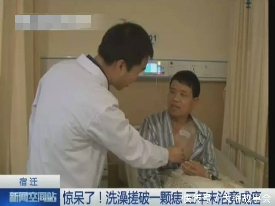 基底细胞癌|只因搓破身上一颗小痣，25岁男子患上癌，这些痣都需要谨慎