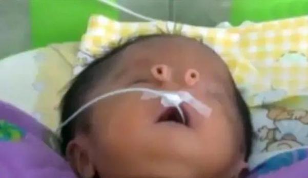 须子|孩子出生后没有鼻子,却拥有两根触角般的“须子”,妈妈悔不当初