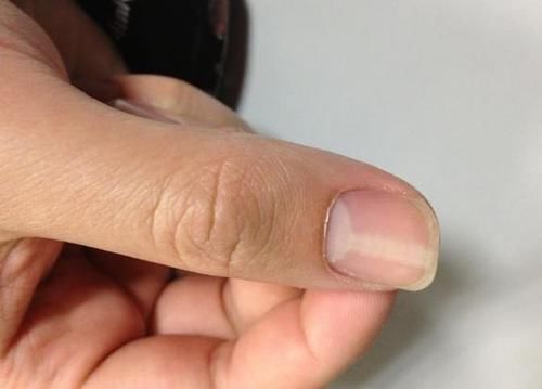 就诊|手上出现这9个表现,可能是体内疾病发出的求救信号,别不当回事!