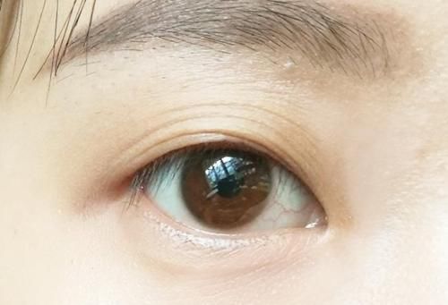 你的眼皮都有几层了?