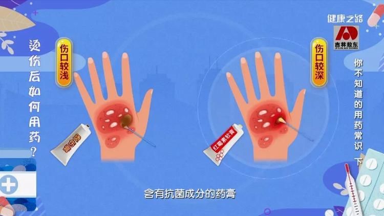 激素类|碘伏、烫伤膏、眼药水……这些经常使用的药您用对了吗？