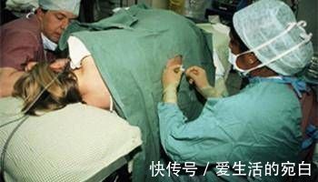 是真的吗|头胎剖腹产,第二胎继续剖,到底有多痛这些有经验的宝妈这样说