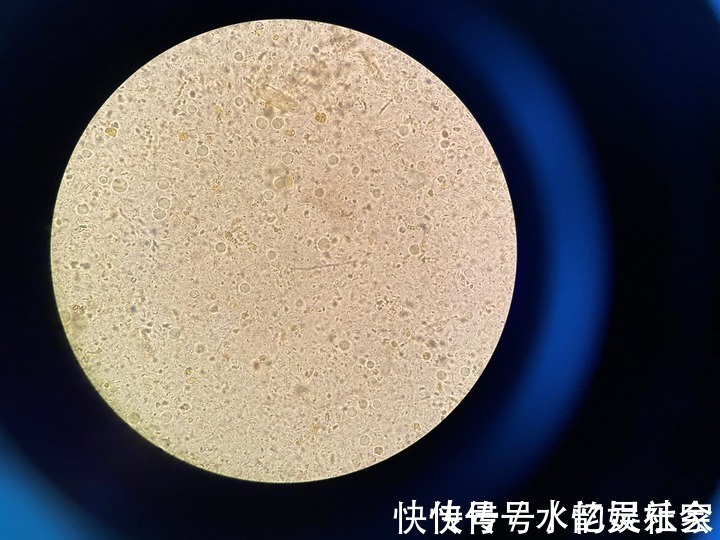 水米|4岁孩子连着狂吐两天还水米不进,最后医生在便便里找到这种虫子