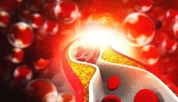 常吃“腐乳”的人,会有什么变化多数人还不清楚,答案让人意外