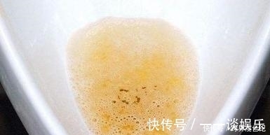 肾脏|接连感冒被查出尿毒症,肾病早期会有4个“求救”信号,不妨一看