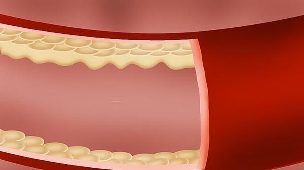黄芪泡水|用黄芪泡水喝,身体能得到哪些好处?一次放多少为宜?有何禁忌?