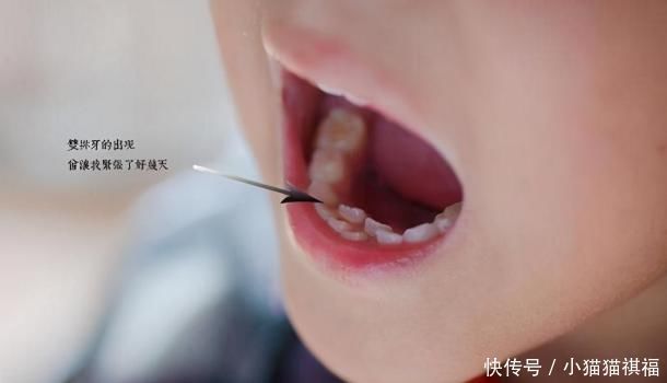 换牙|宝宝长出双排牙,是妈妈在作怪,孩子饮食出问题了!