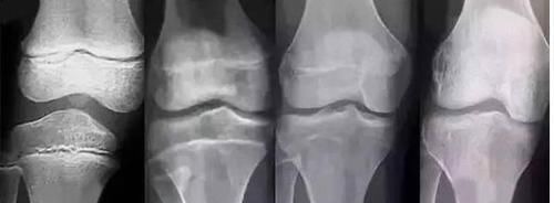 侯倩|10个孩子8个“早熟”,别再怪豆浆奶粉,“元凶”就在家里