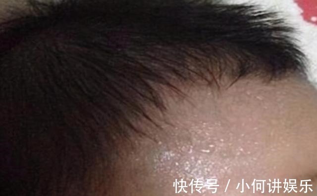 维生素d|孩子一睡觉就出汗,别总以为是缺钙!父母记住3个“关键词”