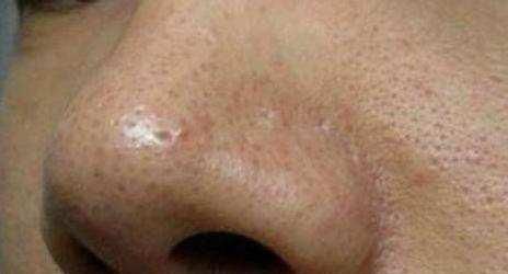 排毒|肝毒“重”的人，身体3处是“黑”的，如果你也有，尽早排毒