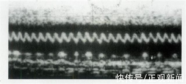 双氧水|大师陨落!“现代超声心动图之父”王新房去世，享年87岁