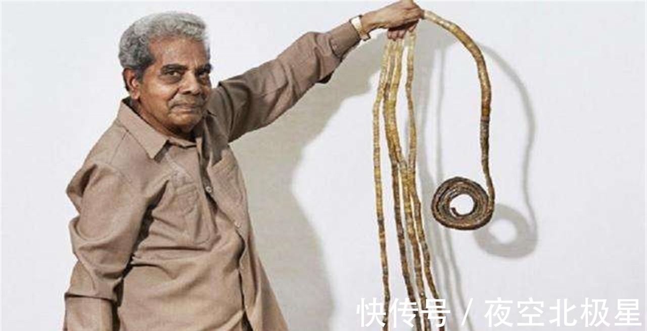 手指|印度大爷留了45年长指甲,剪掉后捐博物馆,不料手指却发生大变化