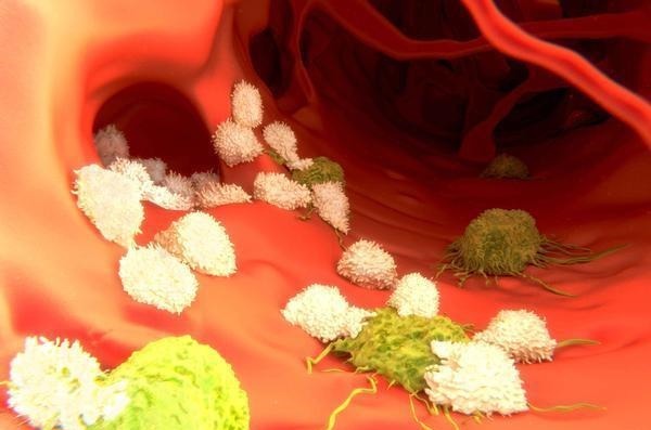 血脂高,如何让血脂降下来?医生为你总结4招,不妨试一试