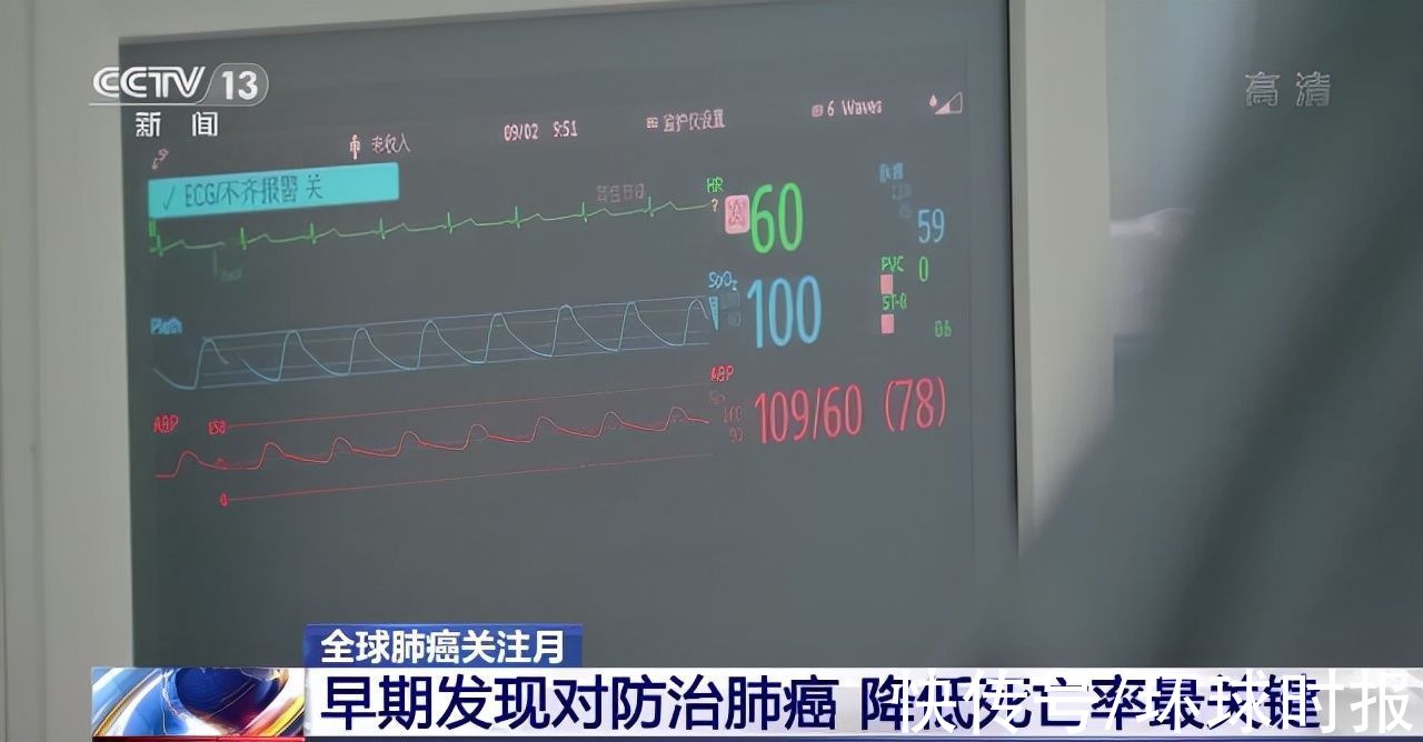 病例|2020年我国新发肺癌病例约87万 规范化治疗至关重要