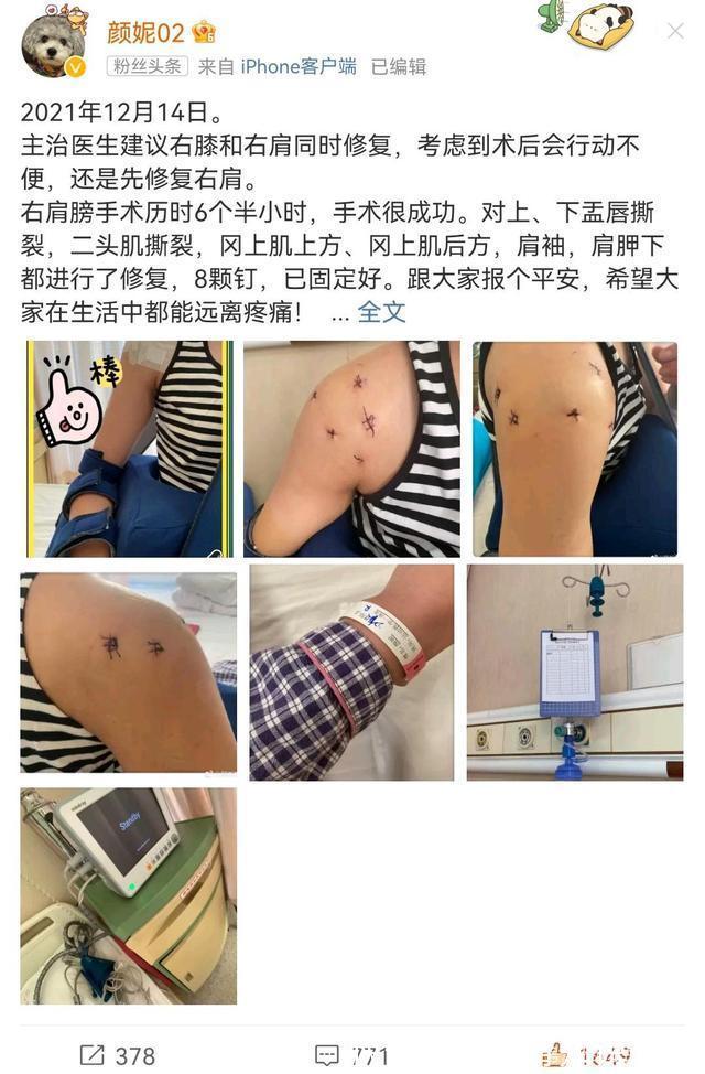 辽宁女排|心疼女排名将颜妮，在北京接受治疗，6小时手术7处修复8颗钉子