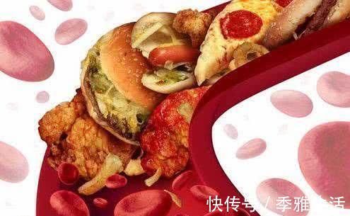 总胆固醇|高血脂的“天敌”已找到,常吃清理血管垃圾,血脂悄悄往下降